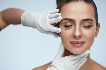Blepharoplasty