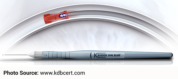 Kahook Dual Blade (KDB)