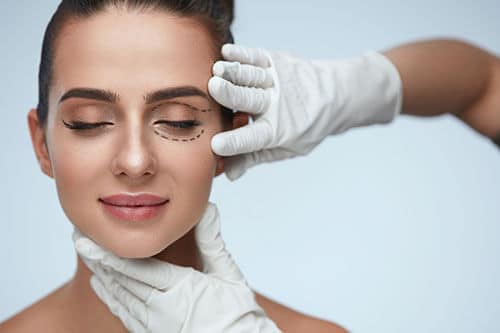 Woman being prepped for blepharoplasty